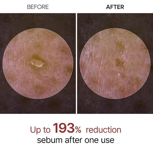 Final 3 Hours: 70% OFF🔥 Gentle Exfoliator Glow Rice Ampoule-Suitable for All Skin Types