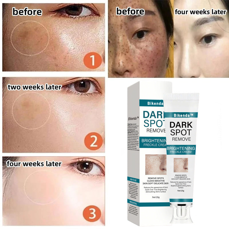 [Official Store]  Blemish Removing Beauty Cream – Fades Dark Spots, Freckles & Wrinkles | Age-Defying, Even-Tone Treatment