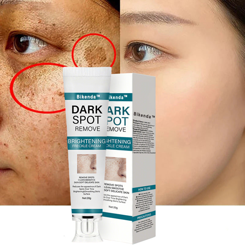 [Official Store]  Blemish Removing Beauty Cream – Fades Dark Spots, Freckles & Wrinkles | Age-Defying, Even-Tone Treatment