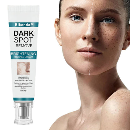 [Official Store]  Blemish Removing Beauty Cream – Fades Dark Spots, Freckles & Wrinkles | Age-Defying, Even-Tone Treatment