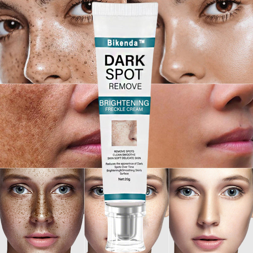 [Official Store]  Blemish Removing Beauty Cream – Fades Dark Spots, Freckles & Wrinkles | Age-Defying, Even-Tone Treatment
