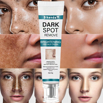 [Official Store]  Blemish Removing Beauty Cream – Fades Dark Spots, Freckles & Wrinkles | Age-Defying, Even-Tone Treatment