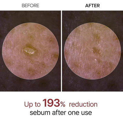 Final 3 Hours: 70% OFF🔥 Gentle Exfoliator Glow Rice Ampoule-Suitable for All Skin Types