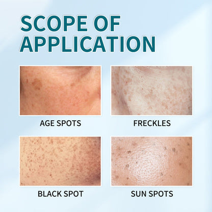 [Official Store]  Blemish Removing Beauty Cream – Fades Dark Spots, Freckles & Wrinkles | Age-Defying, Even-Tone Treatment
