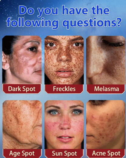 [Official Store]  Blemish Removing Beauty Cream – Fades Dark Spots, Freckles & Wrinkles | Age-Defying, Even-Tone Treatment